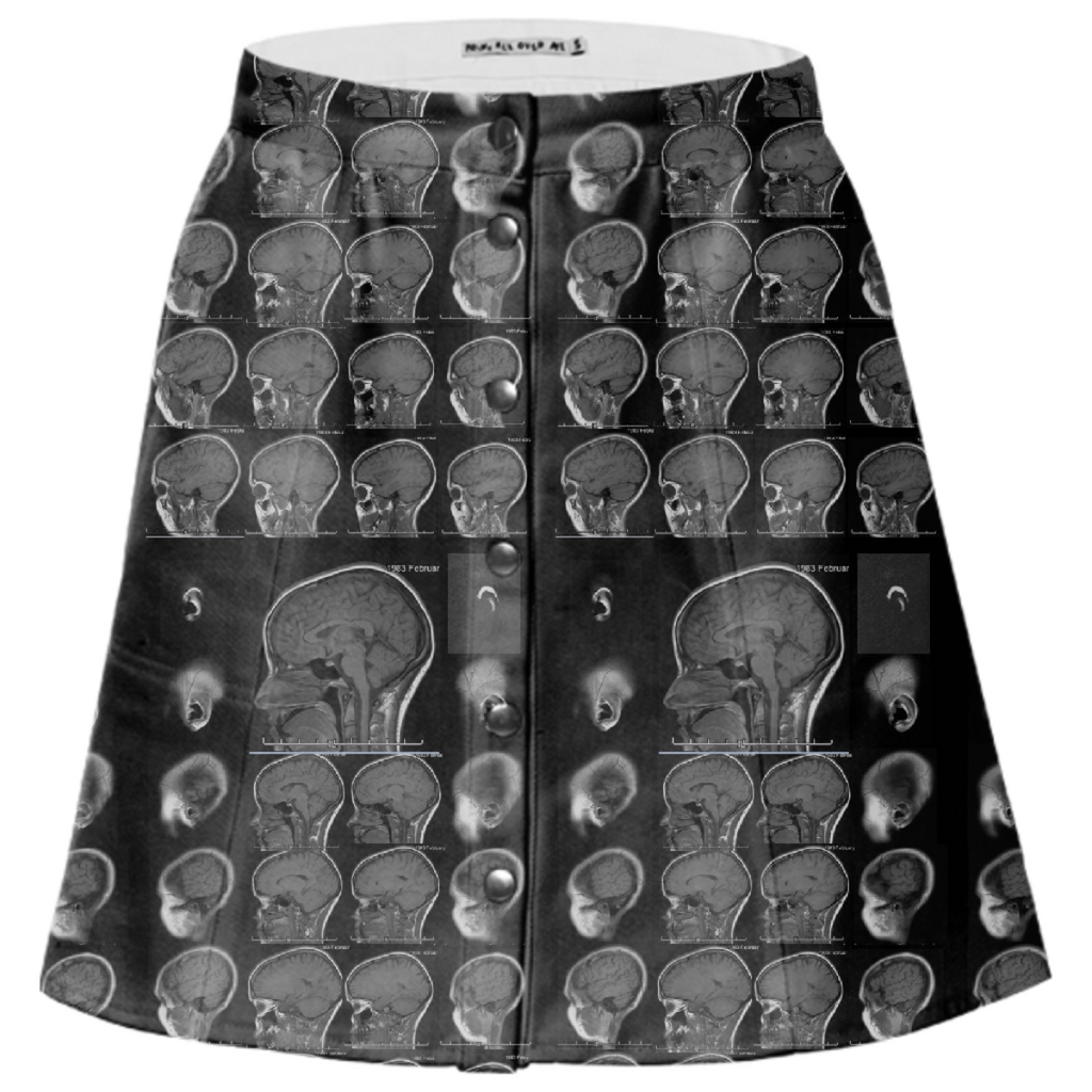 Amanda MRI